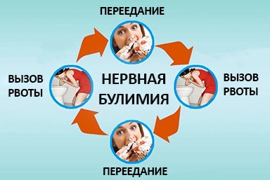 Лечение булимии в Хаджалмахи